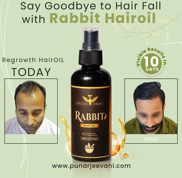 Rabbit blood hair growth oil 30 ml Reduces Hair Fall and Dandruff